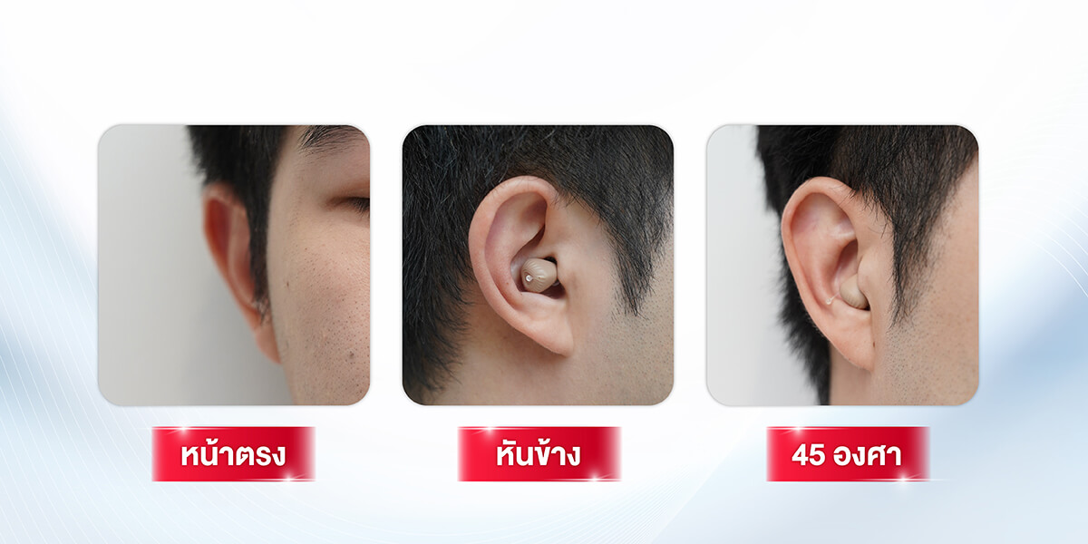 เครื่องช่วยฟัง CICT6 เครื่องช่วยฟัง CICT6