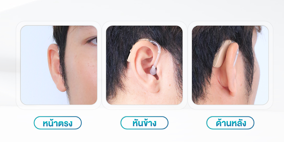 เครื่องช่วยฟัง zircon pro2 เครื่องช่วยฟัง zircon pro2