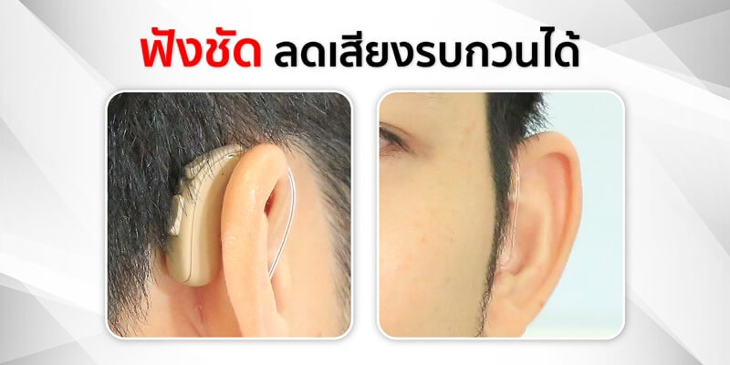 เครื่องช่วยฟัง vertical ric เครื่องช่วยฟัง vertical ric